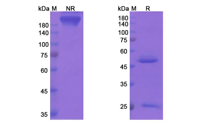 Apolizumab Humanized Antibody in SDS-PAGE (SDS-PAGE)