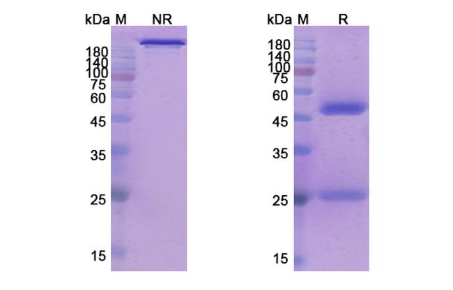 Epratuzumab Humanized Antibody in SDS-PAGE (SDS-PAGE)