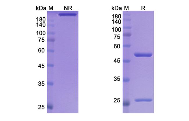Fontolizumab Humanized Antibody in SDS-PAGE (SDS-PAGE)