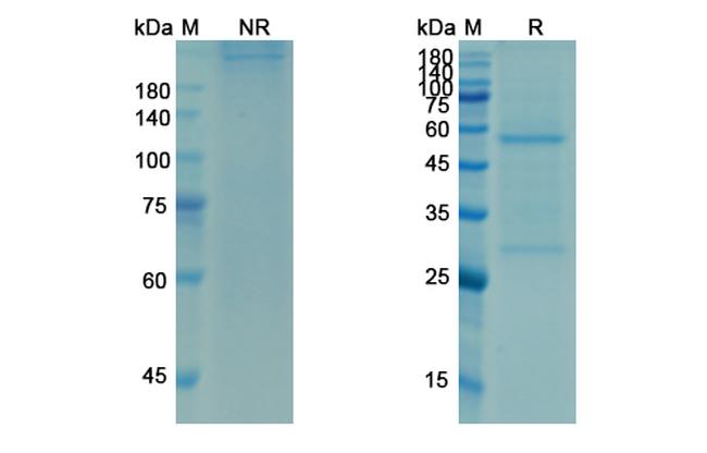 Omalizumab Humanized Antibody in SDS-PAGE (SDS-PAGE)