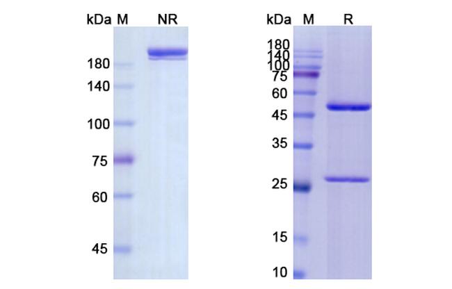 CD4 (Cedelizumab Biosimilar) Antibody in SDS-PAGE (SDS-PAGE)