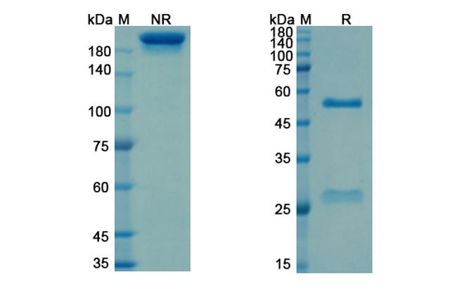 Sevirumab Humanized Antibody in SDS-PAGE (SDS-PAGE)