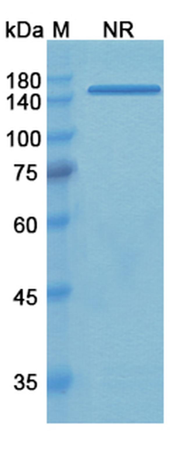 CD51/CD61 (Tadocizumab Biosimilar) Antibody in SDS-PAGE (SDS-PAGE)