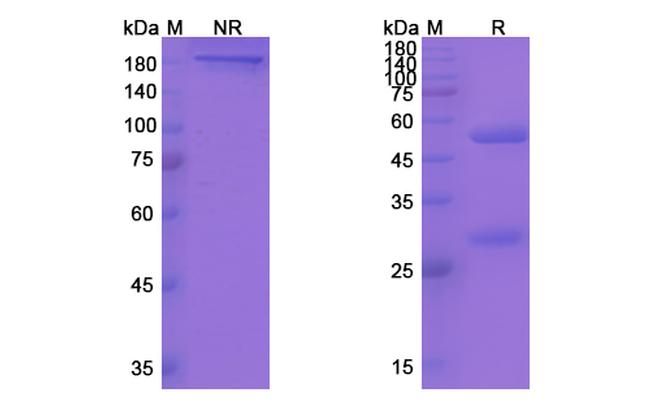 CD18 (Yfc51.1Mab Biosimilar) Antibody in SDS-PAGE (SDS-PAGE)