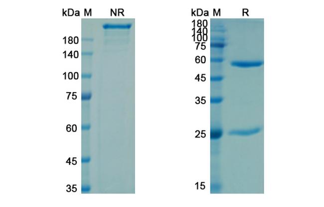 CD4 (Campath-9H Biosimilar) Antibody in SDS-PAGE (SDS-PAGE)