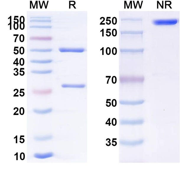 Imciromab Antibody in SDS-PAGE (SDS-PAGE)