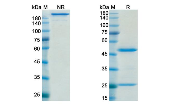 Muromonab Antibody in SDS-PAGE (SDS-PAGE)