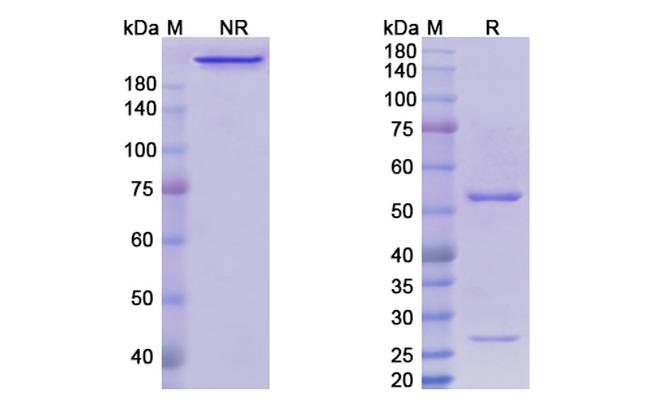 Nofetumomab Antibody in SDS-PAGE (SDS-PAGE)