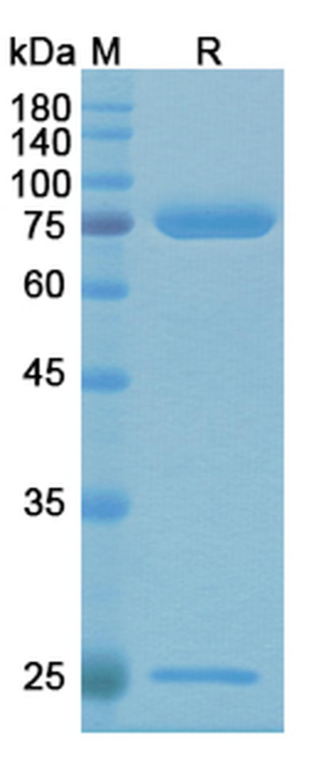 Alg-991 Chimeric Antibody in SDS-PAGE (SDS-PAGE)