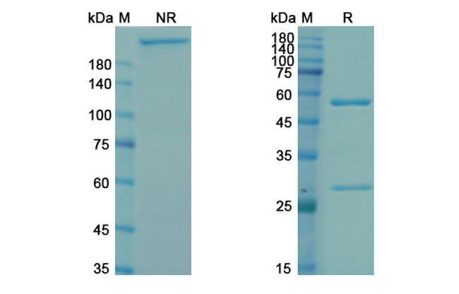 Bavituximab Chimeric Antibody in SDS-PAGE (SDS-PAGE)