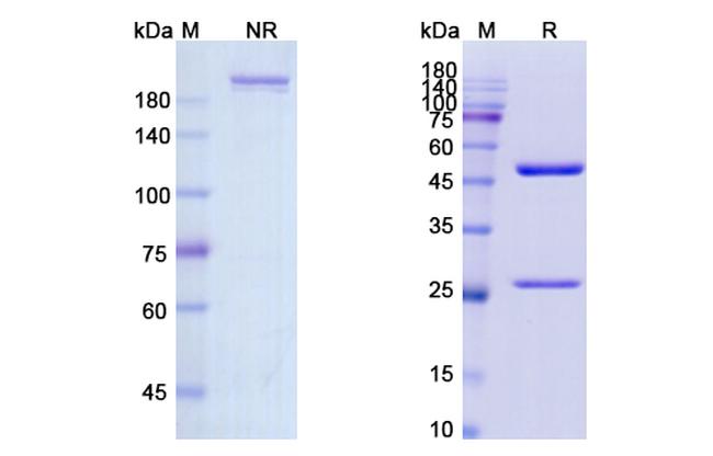 CD4 (Clenoliximab Biosimilar) Antibody in SDS-PAGE (SDS-PAGE)