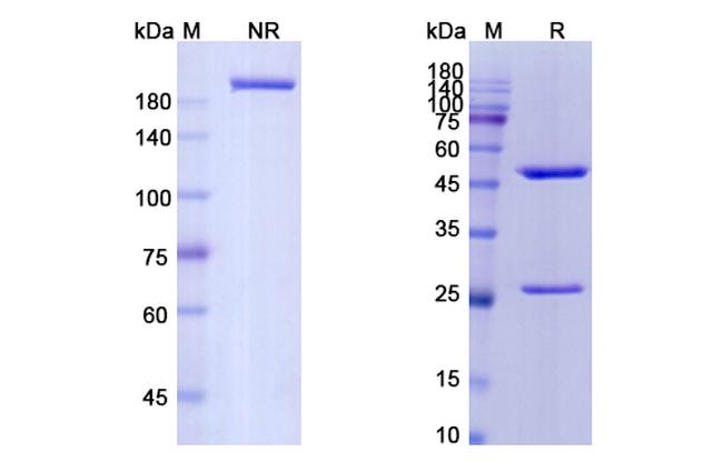 CD4 (Keliximab Biosimilar) Antibody in SDS-PAGE (SDS-PAGE)