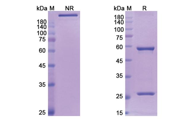 Lumiliximab Chimeric Antibody in SDS-PAGE (SDS-PAGE)
