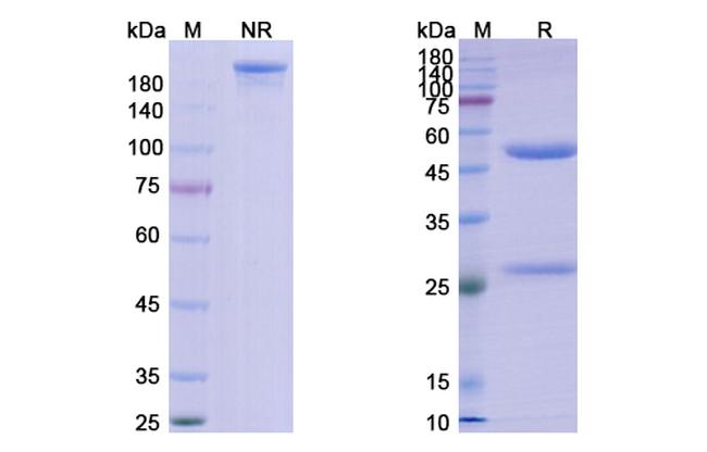 Oncolym Antibody in SDS-PAGE (SDS-PAGE)
