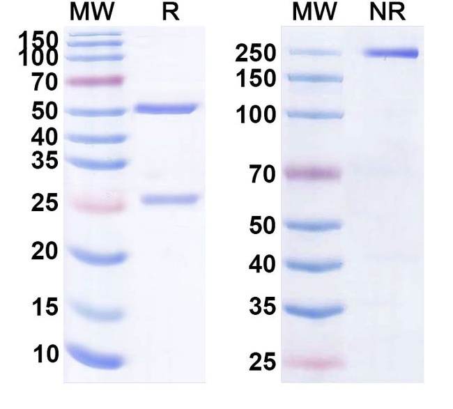 Al-901 Antibody in SDS-PAGE (SDS-PAGE)