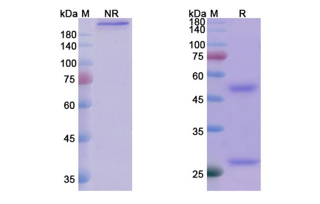 Tuvirumab Antibody in SDS-PAGE (SDS-PAGE)
