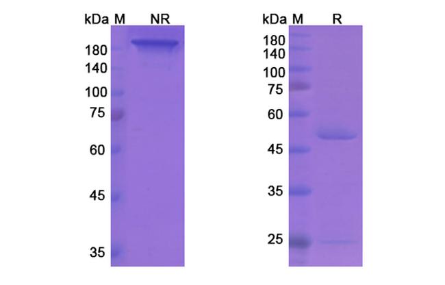 Regavirumab Antibody in SDS-PAGE (SDS-PAGE)
