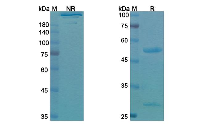 Votumumab Antibody in Western Blot (WB)