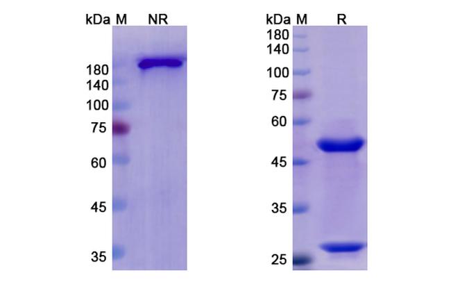 Otelixizumab Humanized Antibody in SDS-PAGE (SDS-PAGE)