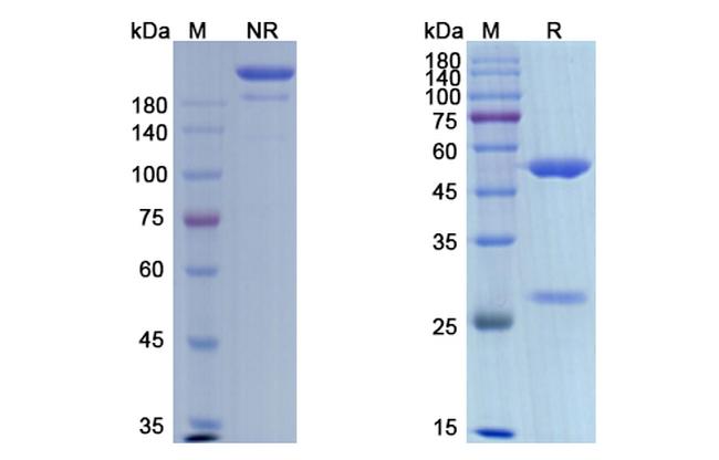 ITGAV/ITGB3 (Etaracizumab Biosimilar) Antibody in SDS-PAGE (SDS-PAGE)