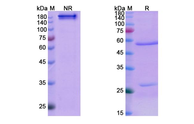 Denosumab Antibody in SDS-PAGE (SDS-PAGE)