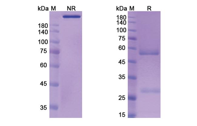 Aselizumab Humanized Antibody in SDS-PAGE (SDS-PAGE)