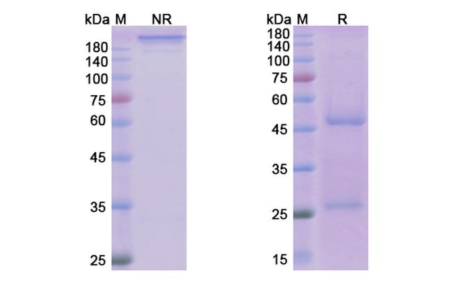 Reslizumab Humanized Antibody in SDS-PAGE (SDS-PAGE)