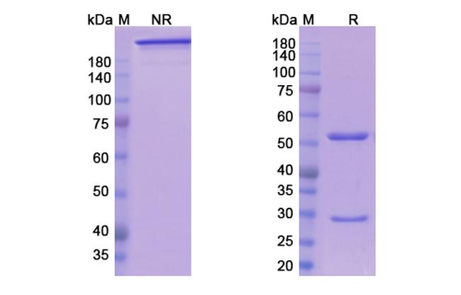 Ensituximab Chimeric Antibody in SDS-PAGE (SDS-PAGE)