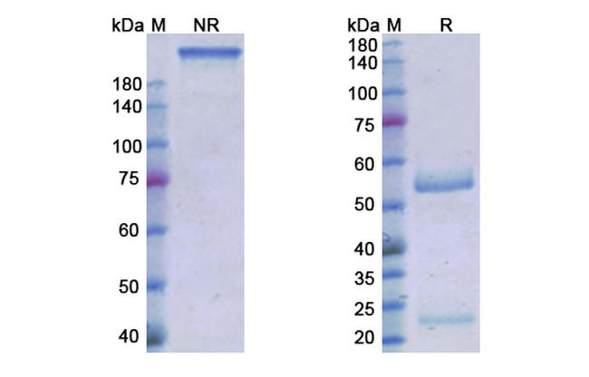 Roledumab Antibody in SDS-PAGE (SDS-PAGE)