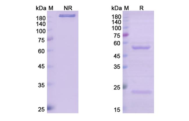 Narnatumab Antibody in SDS-PAGE (SDS-PAGE)