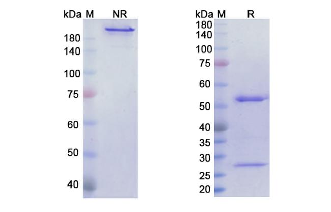 Futuximab Chimeric Antibody in SDS-PAGE (SDS-PAGE)