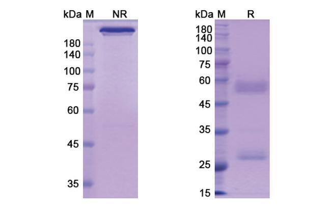 Perakizumab Humanized Antibody in SDS-PAGE (SDS-PAGE)