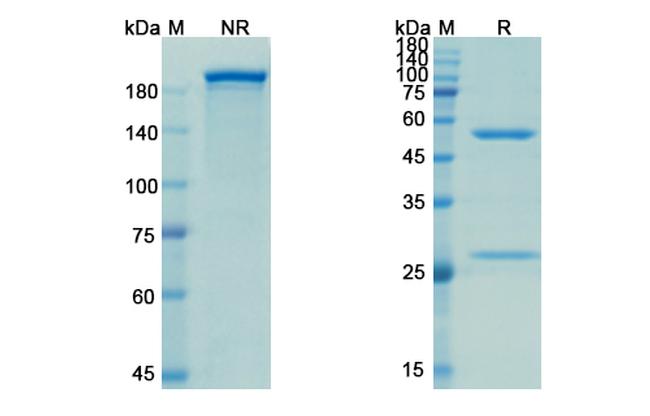 Evolocumab Antibody in SDS-PAGE (SDS-PAGE)