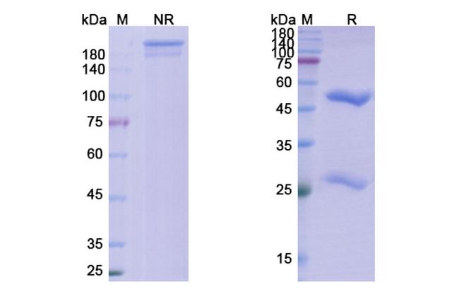 Pritoxaximab Chimeric Antibody in SDS-PAGE (SDS-PAGE)
