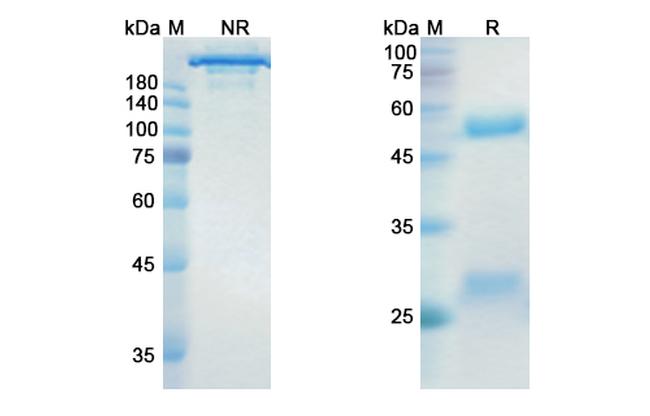 Dinutuximab Chimeric Antibody in SDS-PAGE (SDS-PAGE)