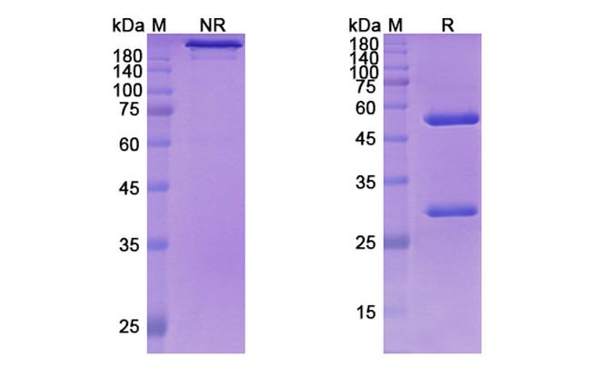 Coltuximab Chimeric Antibody in SDS-PAGE (SDS-PAGE)