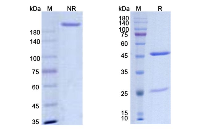 Diridavumab Antibody in SDS-PAGE (SDS-PAGE)