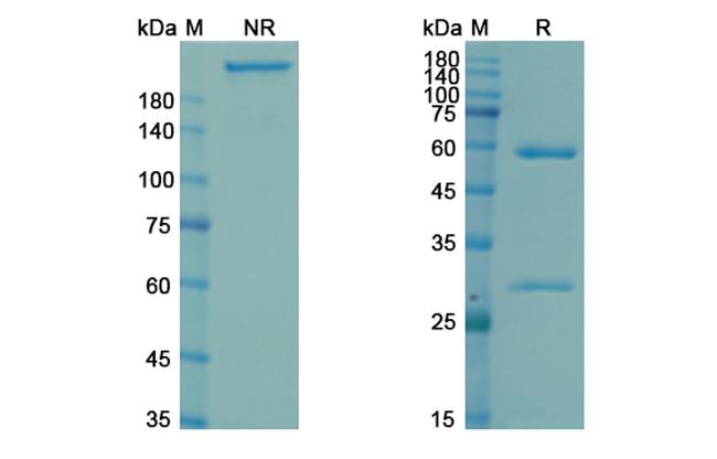 Navivumab Antibody in SDS-PAGE (SDS-PAGE)
