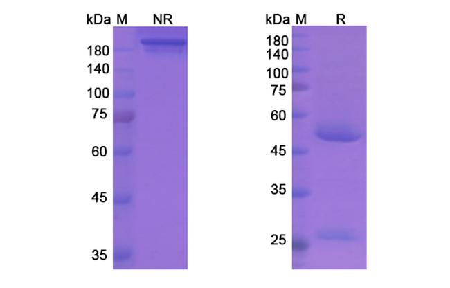 Plozalizumab Humanized Antibody in SDS-PAGE (SDS-PAGE)