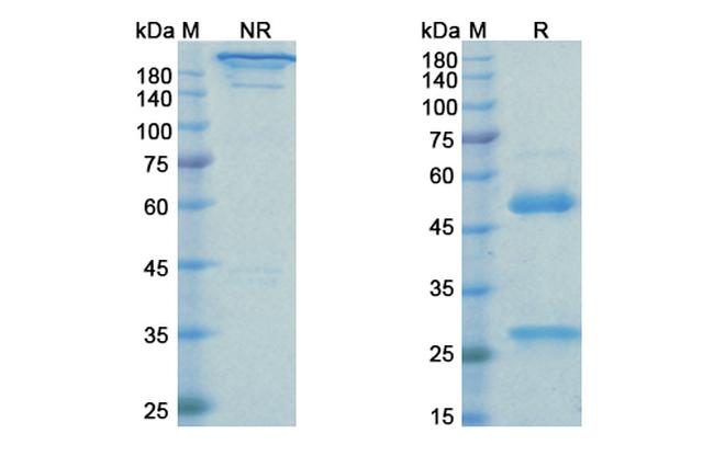 PDGFRB (CD140b) (Rinucumab Biosimilar) Antibody in SDS-PAGE (SDS-PAGE)