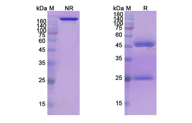 Refanezumab Humanized Antibody in SDS-PAGE (SDS-PAGE)