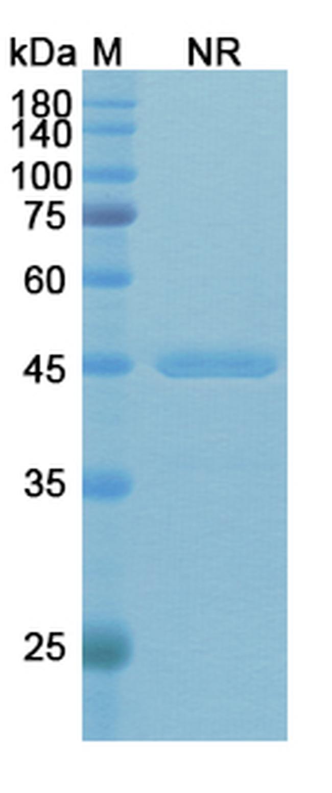Pseudomonas aeruginosa (Rivabazumab Biosimilar) Antibody in SDS-PAGE (SDS-PAGE)
