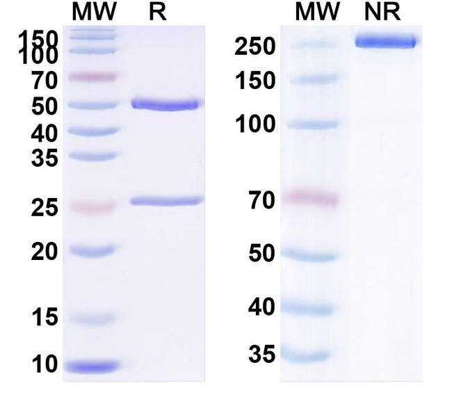 CD37 (Naratuximab Biosimilar) Antibody in SDS-PAGE (SDS-PAGE)
