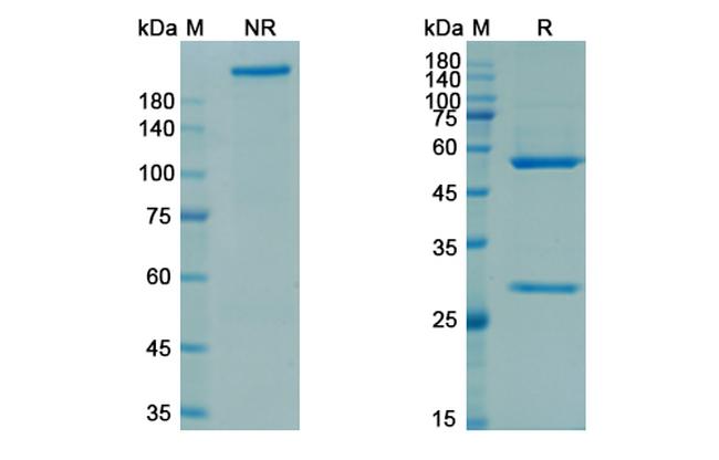 Rozanolixizumab Chimeric Antibody in SDS-PAGE (SDS-PAGE)