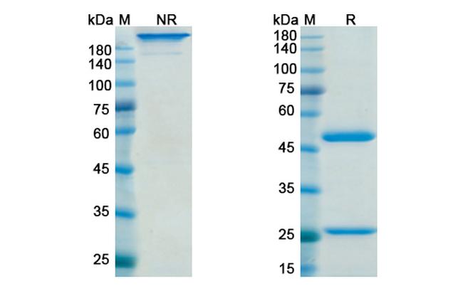 Gimsilumab Antibody in SDS-PAGE (SDS-PAGE)