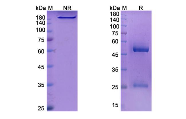Lenvervimab Humanized Antibody in SDS-PAGE (SDS-PAGE)