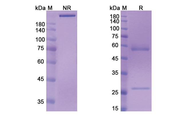 AMHR2 (Murlentamab Biosimilar) Antibody in SDS-PAGE (SDS-PAGE)