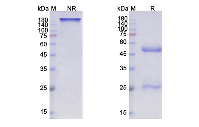 Complement C5 (Pozelimab Biosimilar) Antibody in SDS-PAGE (SDS-PAGE)