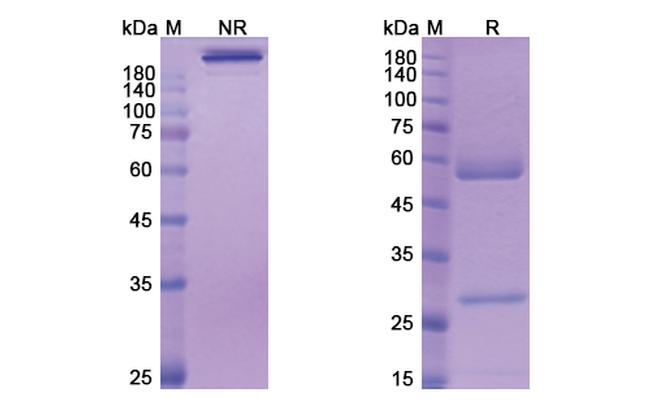 Volagidemab Antibody in SDS-PAGE (SDS-PAGE)
