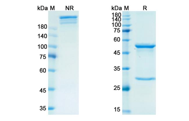 Retifanlimab Chimeric Antibody in SDS-PAGE (SDS-PAGE)